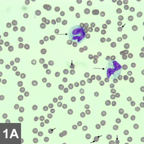 Cytology showing RBCs, some containing 1 or more small, rounded basophilic structures, and 2 neutrophils.