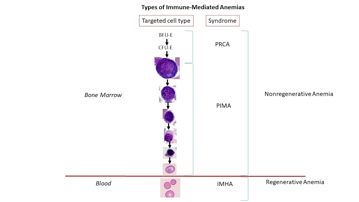Illustration showing types of immune-mediated anemias.