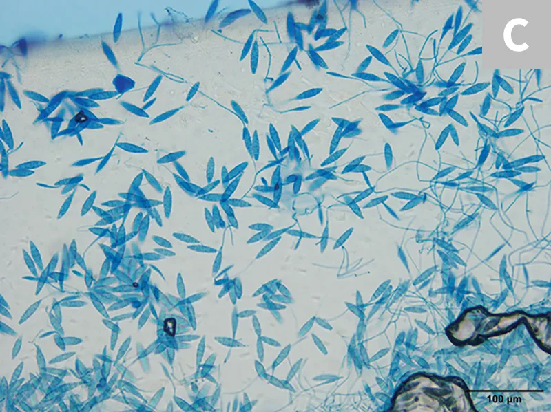 Cytologic appearance of M gypseum macroconidia at 2 different magnifications.