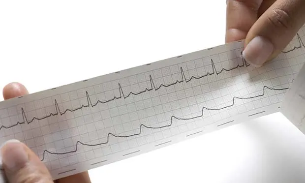 Two hands holding a printed ECG strip against a white background.