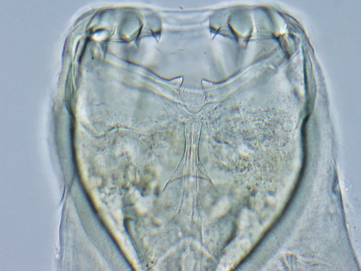 Side-by-side close-ups of teeth in hookworm mouth.