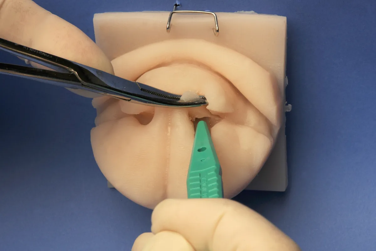 Hemostats grasping the loose end of the alar fold while a scalpel is positioned with the blade facing laterally inside the nares of a silicone model of a dog's nose.