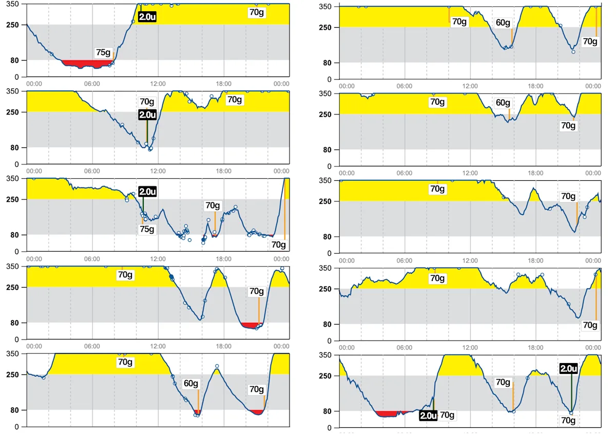 Eight graphs from continuous blood glucose monitor readings illustrating improved but suboptimal blood glucose control.