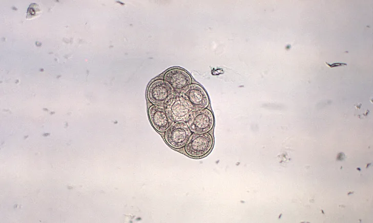 Photomicrograph showing ultrastructural details of a Dipylidium caninum egg packet.
