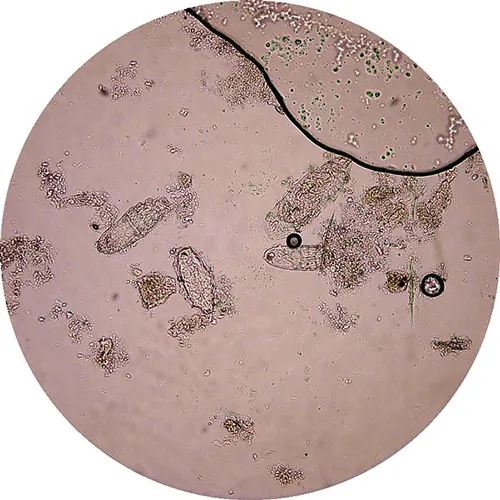 Microscopic image of an adult Demodex mite.