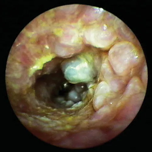 selected slide image