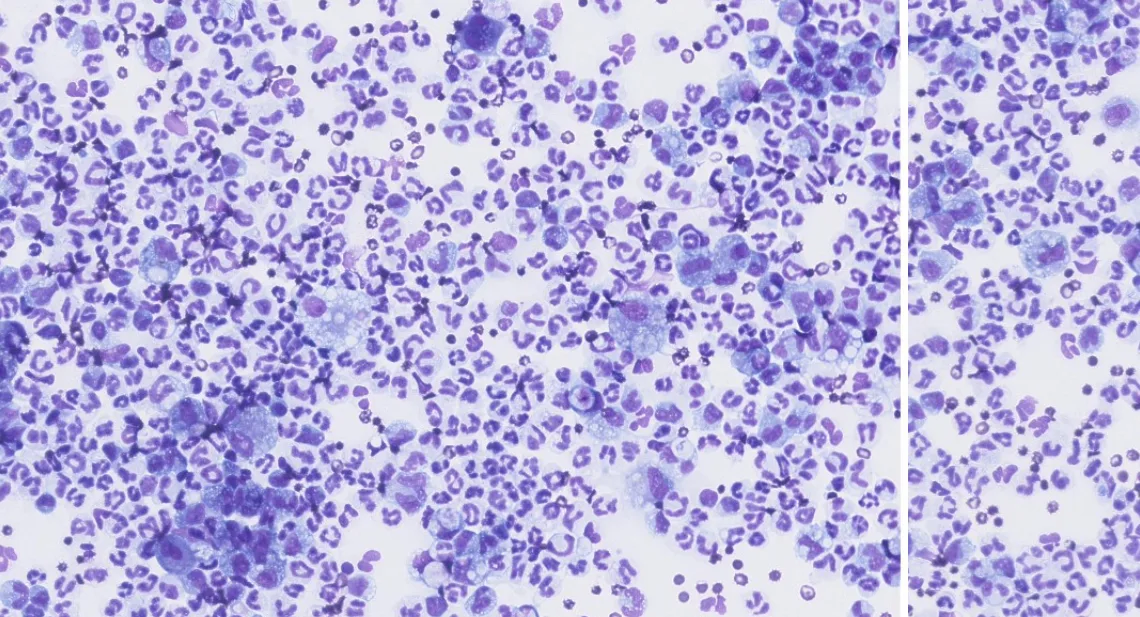 Highly cellular cytology of pleural fluid from dog.