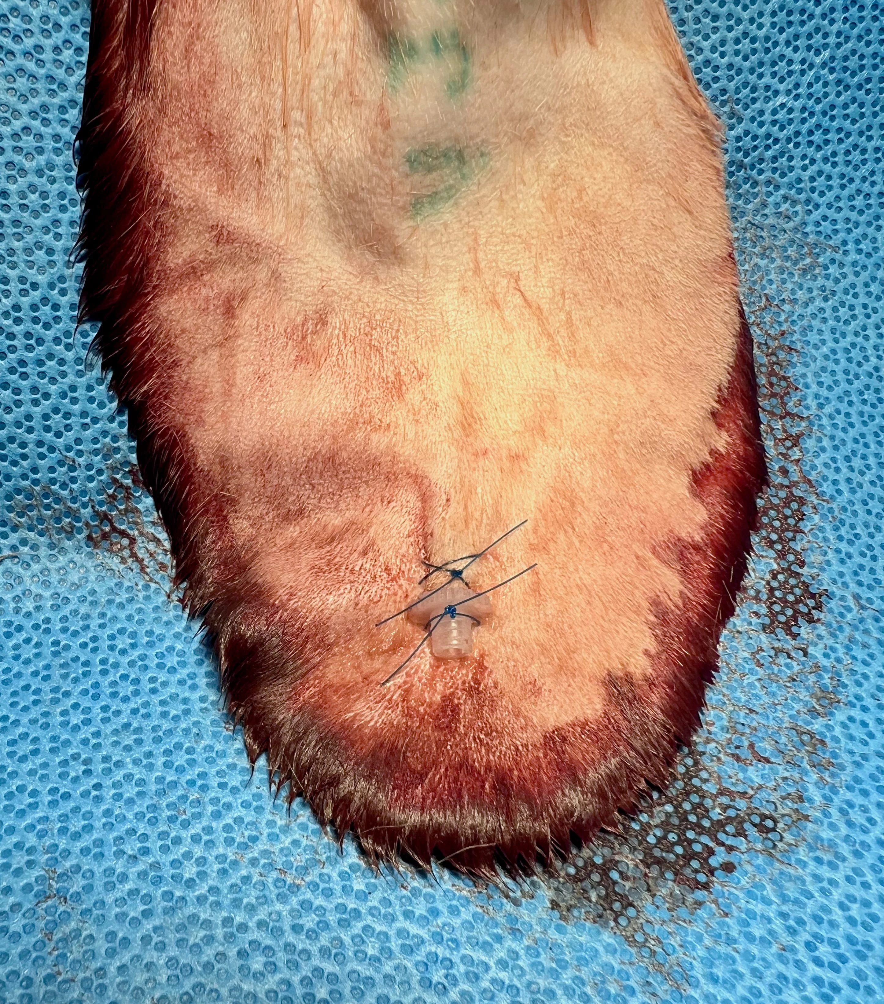 Teat cannula being used for hematoma drainage of the pinna. 