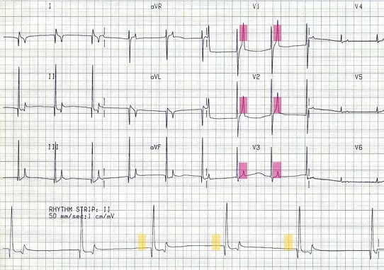 ECG results of a cat.