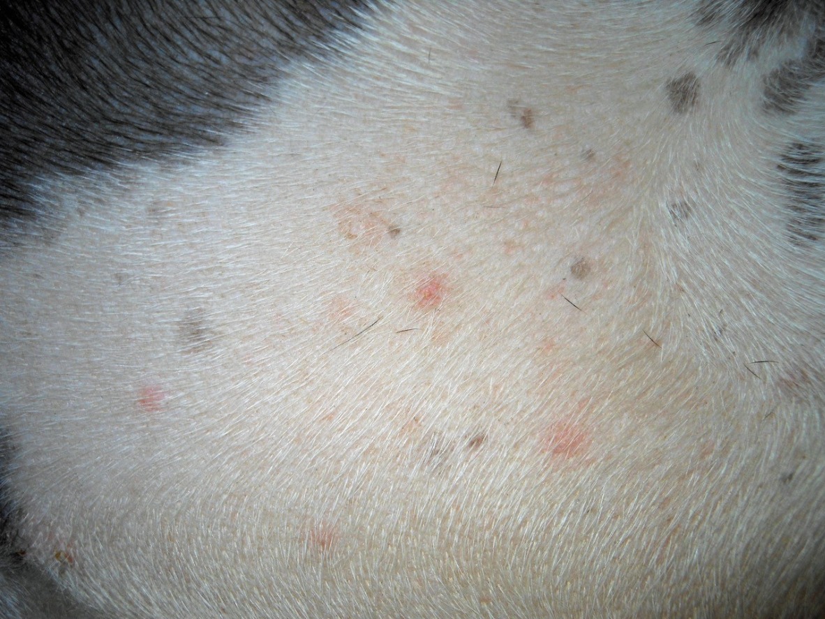 Clinical Image: What Skin Lesions Can Be Seen?