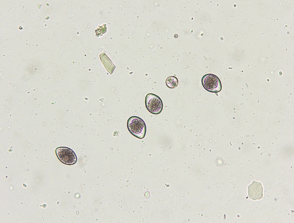 Slide showing oocysts.