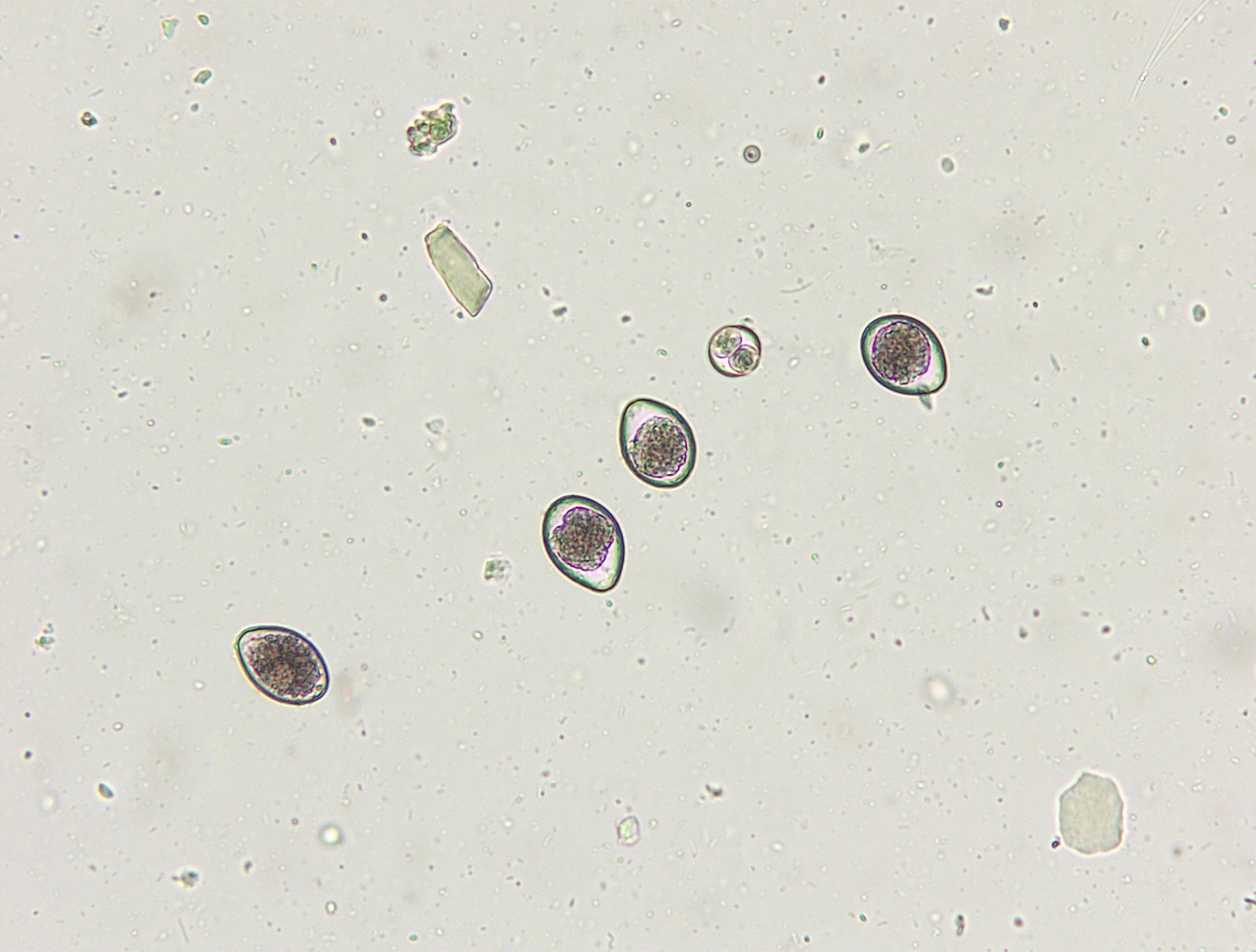 Slide showing oocysts.