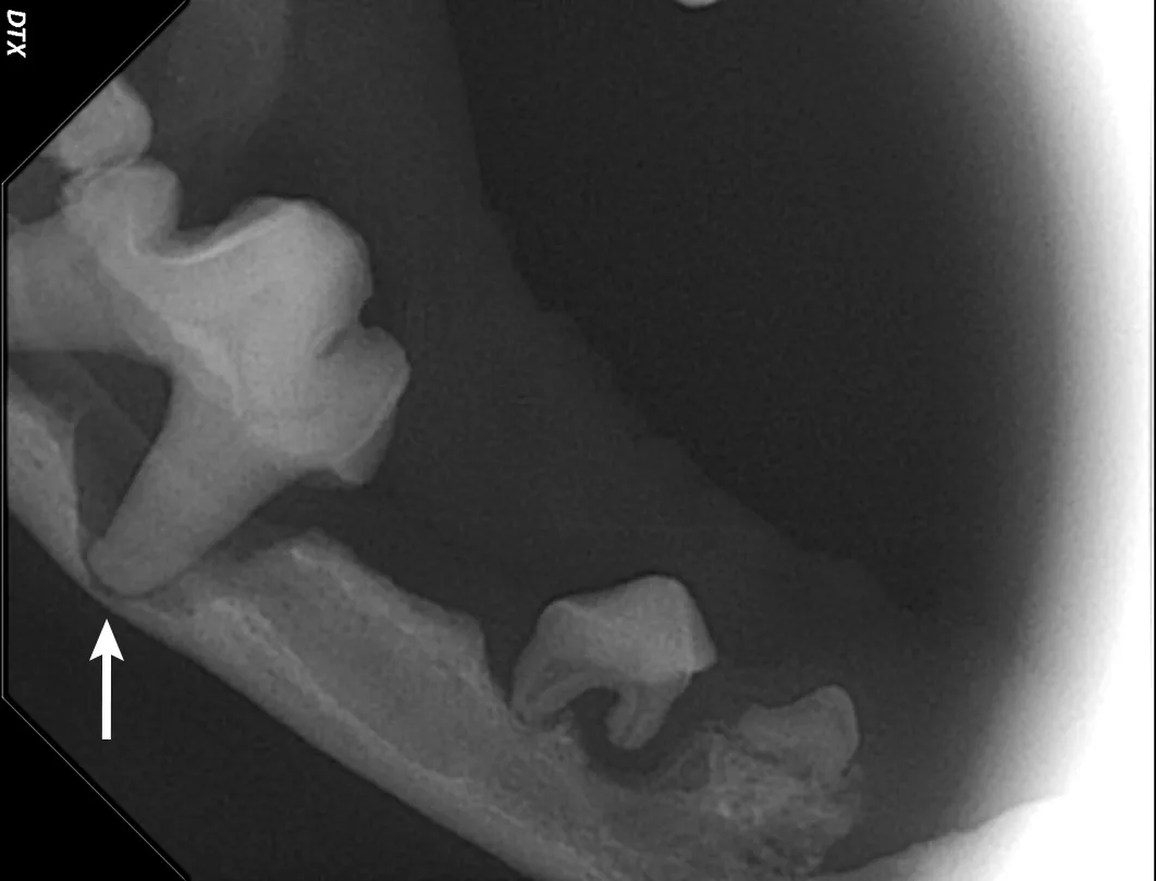 A dental radiograph showing thinning of the mandible due to periodontal disease.