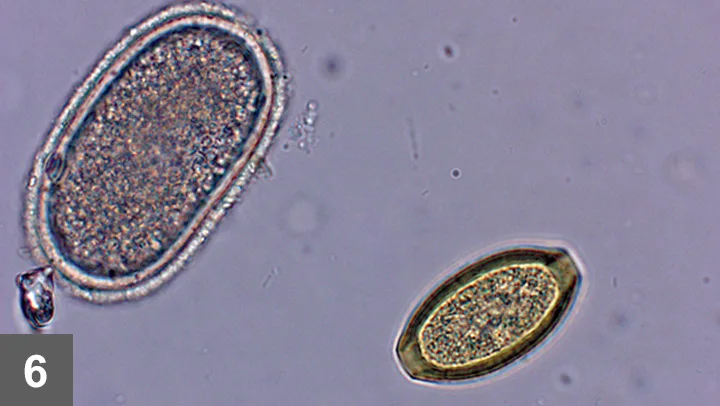 A microscopic image showing two different species of parasite eggs.