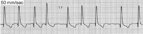 Interpreting ECGs with Confidence: Part 2 | Clinician's Brief