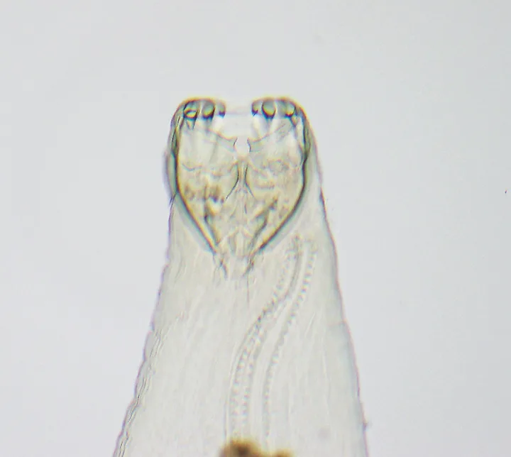Side-by-side close-ups of teeth in hookworm mouth.