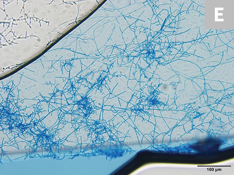 Cytologic appearance of T mentagrophytes macroconidia at 2 different magnifications.