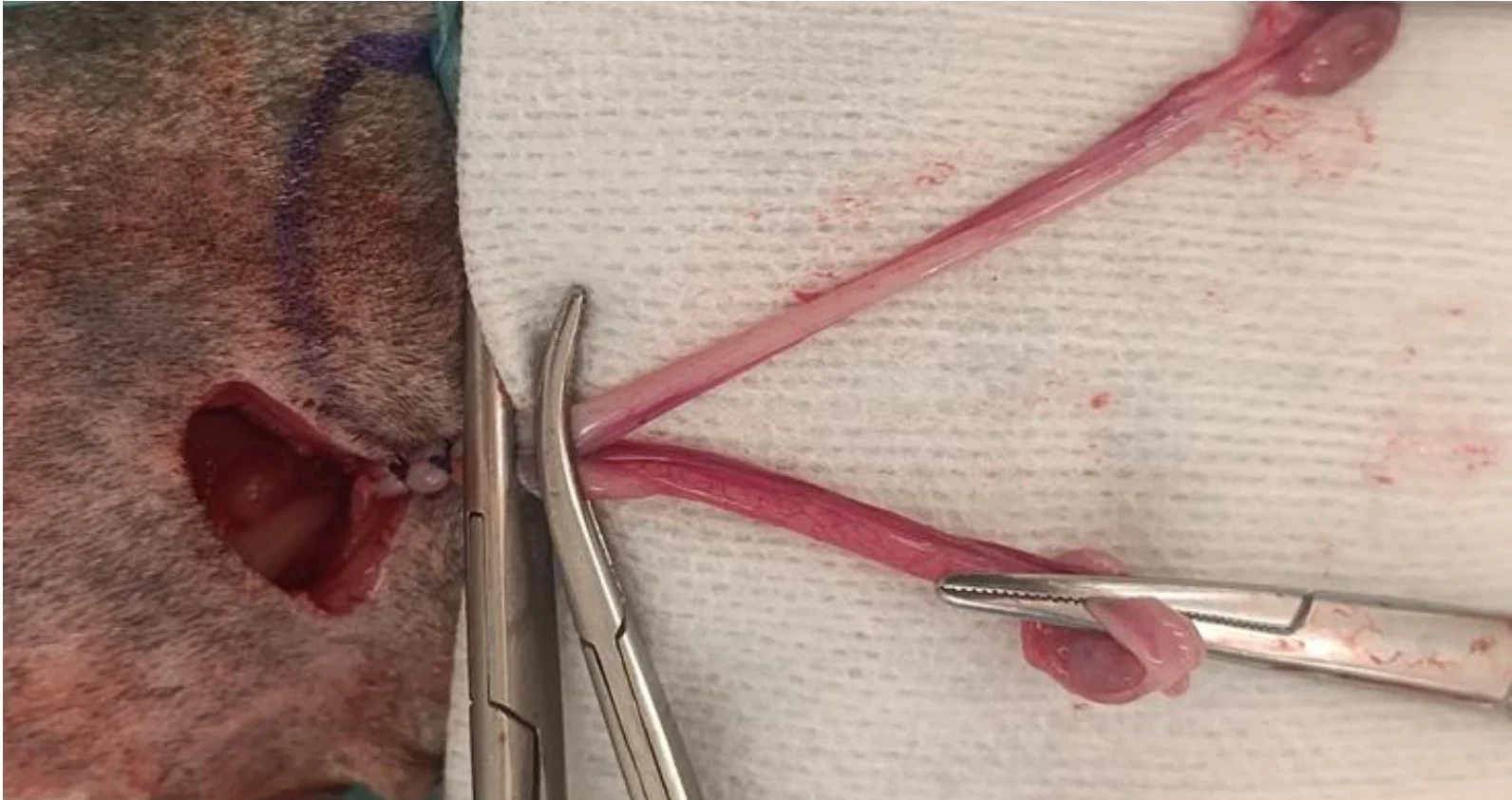 Two forceps clamped across exteriorized uterine body with 2 sutures visible around uterine body distal to forceps.