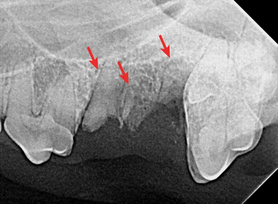 Dental X-ray with arrows pointing to root fractures of the 4th maxillary premolar in a dog.