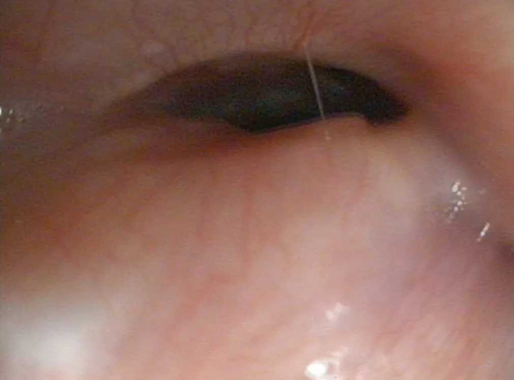 Featured Image