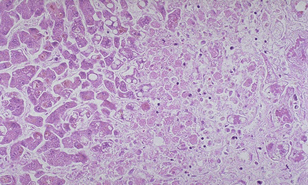 Noncutaneous Adverse Drug Reactions