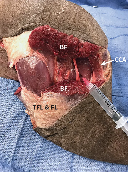 Lateral canine pelvic limb with transected muscle bellies labeled and needle and syringe pointing to sciatic nerve.
