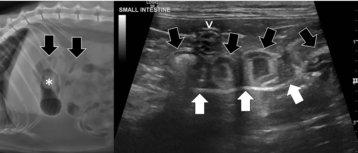 Side-by-side abdominal images demonstrating changes associated with a toy ball connected to a linear foreign body.