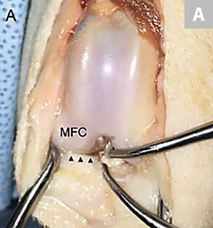 selected slide image