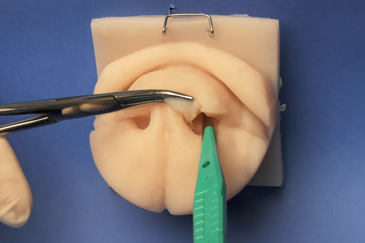 Hemostats grasping the loose end of alar fold while a scalpel incises the fold in a lateral direction inside the nares of a silicone model of a dog's nose,