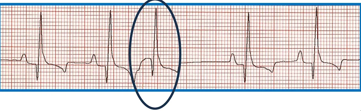 selected slide image