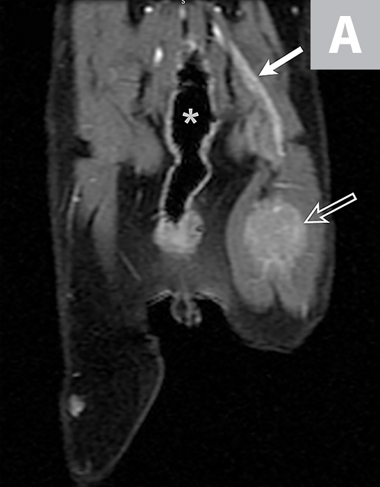 Feline Malignant Nerve Sheath Neoplasm Clinician's Brief