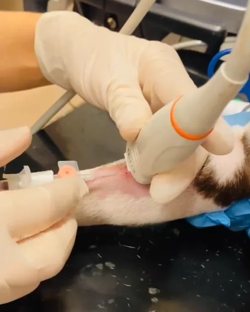 Gloved hands holding ultrasound probe and catheter with blood in hub inserted into vein.