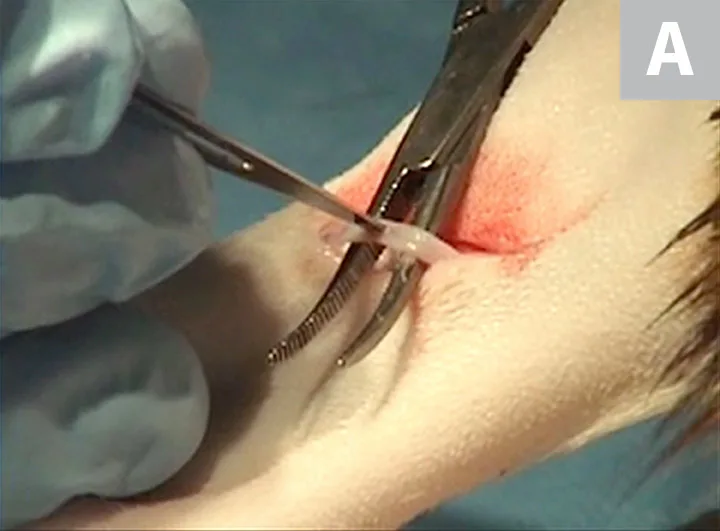 Two images showing incising of saphenous vein and bent needle inserted into incised vein to ready it for catheterization.