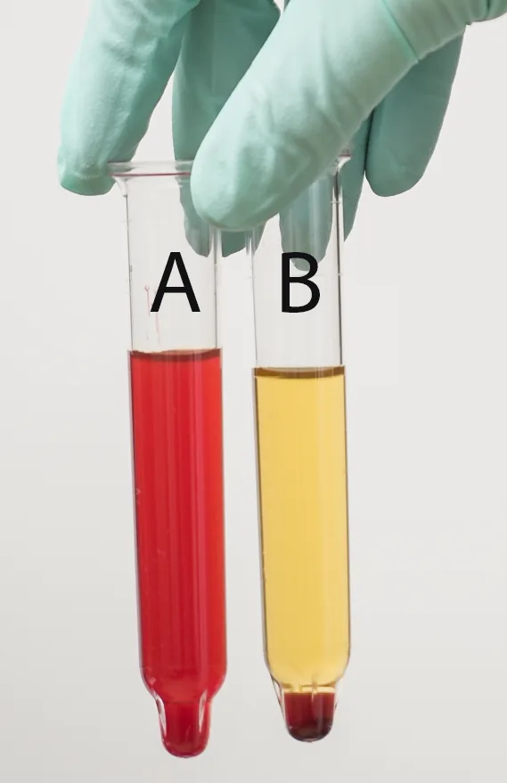 Gloved hand holding 2 clear tubes, with one containing clear red liquid and the other containing clear yellow liquid with a red clump at the bottom.
