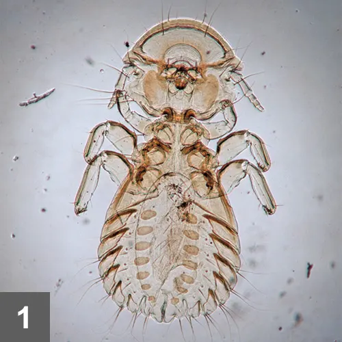 A microscopic image of a poultry louse.