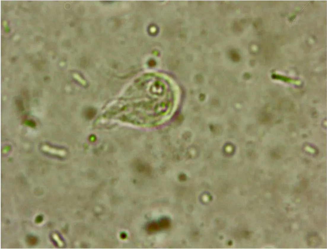 Slide showing a trophozoite.