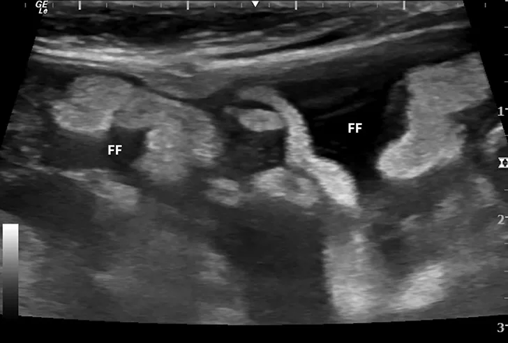 Abdominal ultrasound images from a cat. 