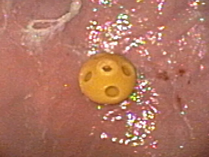 selected slide image