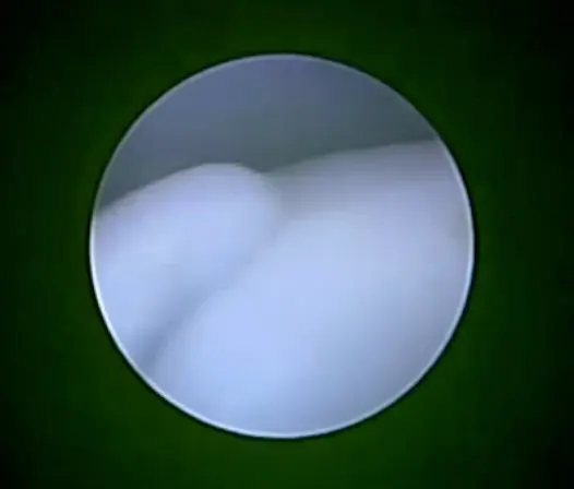 Arthroscopic image in a dog.