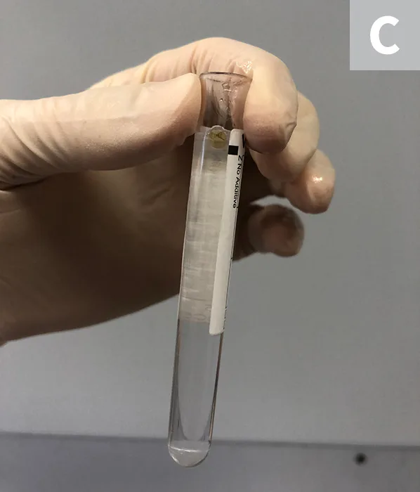 A hand holding a test tube to demonstrate the Rivalta test. 