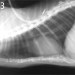 Gastrointestinal Perforation