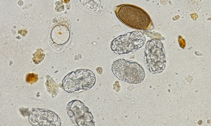 Fecal cytology slide showing several hookworm eggs at varying stages of maturation and a single whipworm egg.