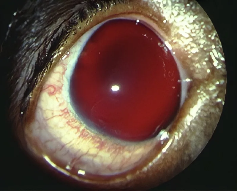 Close-up of eye with hyperemic pale yellow iris and  entire posterior chamber obscured by red material.