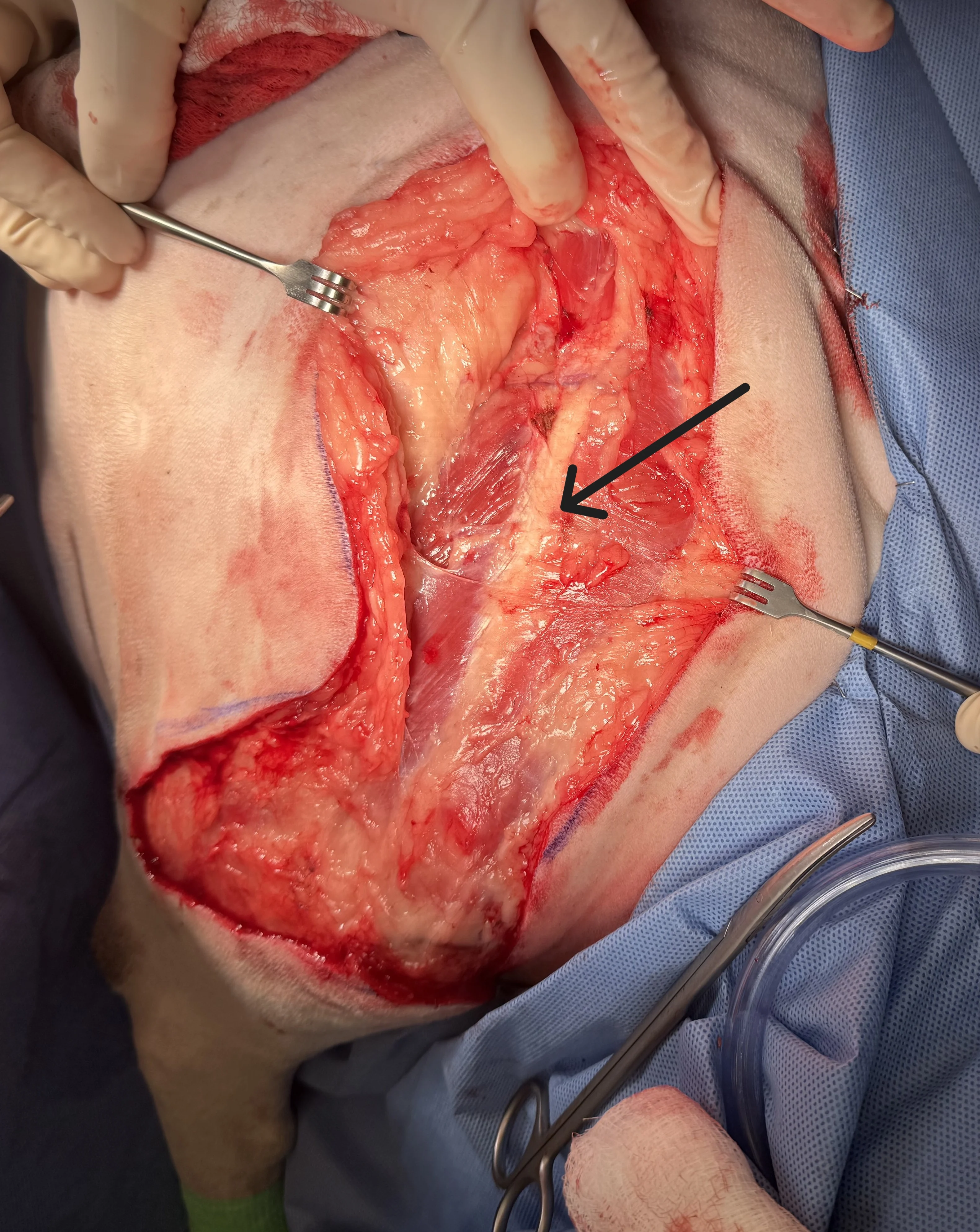 Retractors held on either side of large incision over right forelimb  with arrow pointing to visible scapular spine.