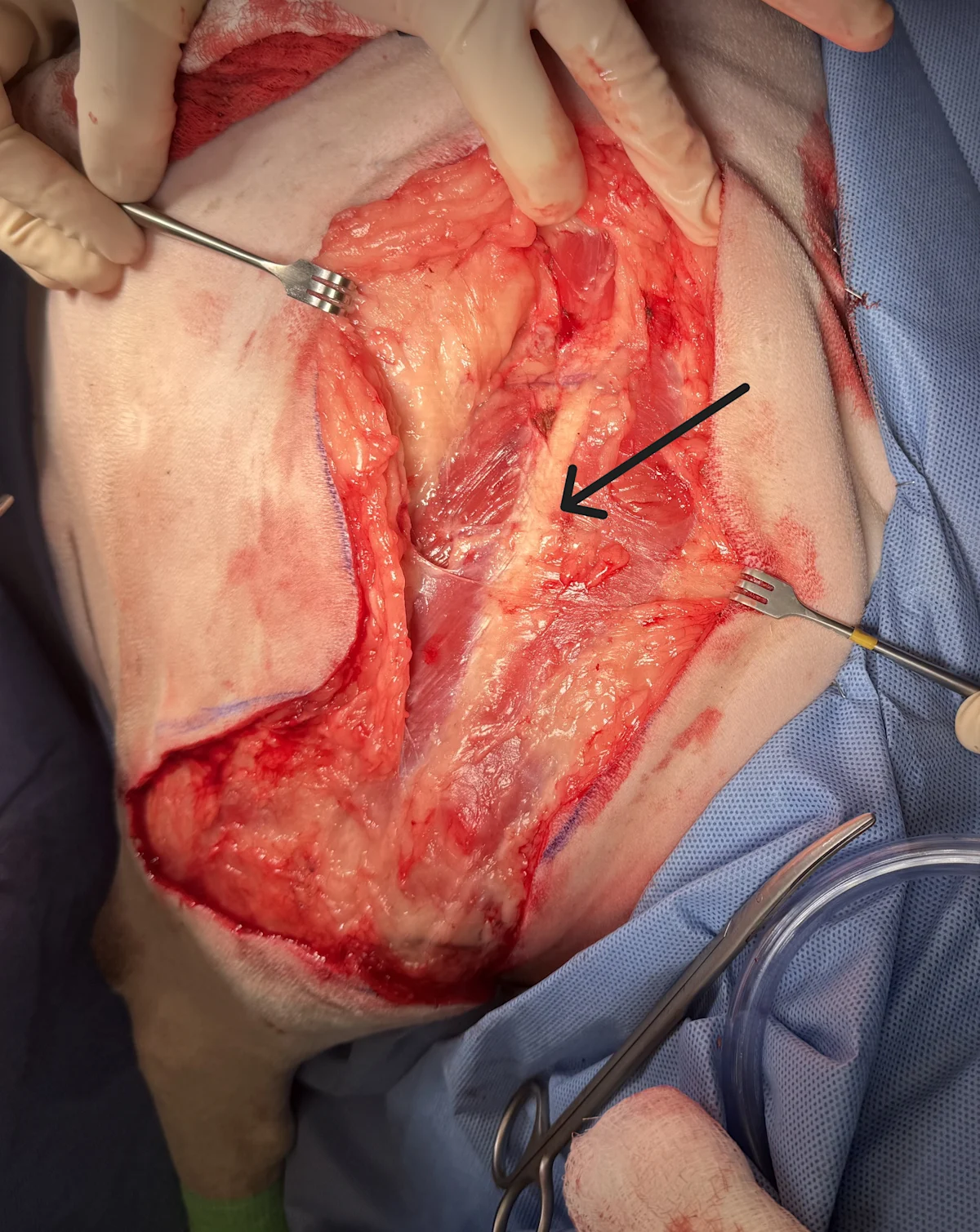 Retractors held on either side of large incision over right forelimb with arrow pointing to visible scapular spine.