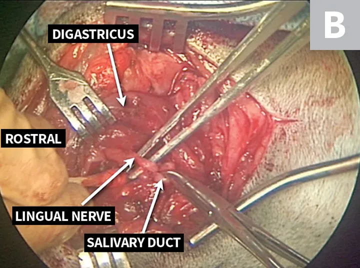Side-by-side intraoperative images showing labeled relevant anatomic structures in region of salivary gland.