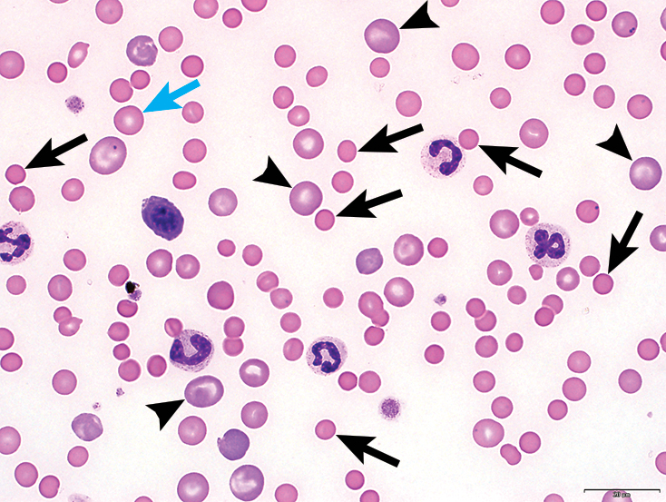 Image Gallery Red Blood Cell Evaluation in Blood Films