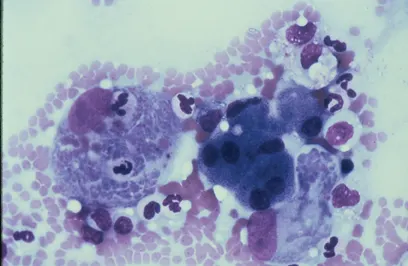 Liver cytology showing very small dark-staining organisms within a macrophage.