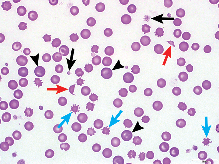 Polychromatophilic Erythrocyte