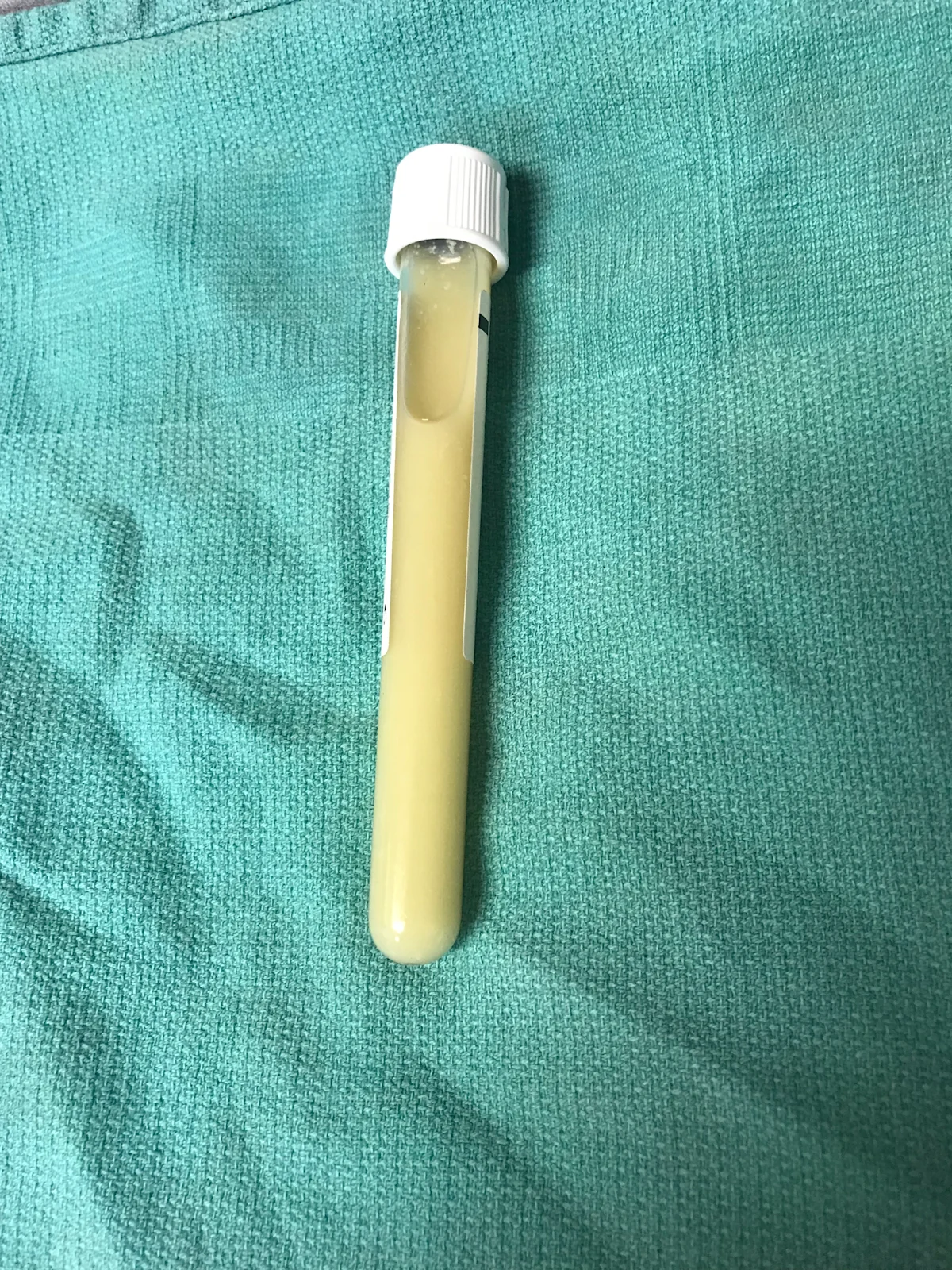 Glass vial with opaque yellow fluid lying on surgical drape.